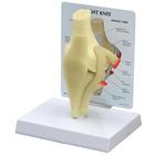 Basic Knee Model