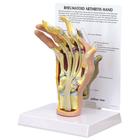 Rheumatoid Arthritis Hand Model