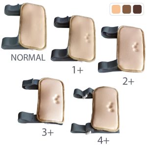 MW1  Pitting Edema Simulator