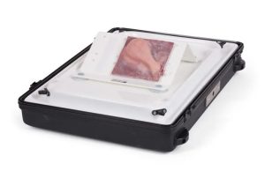 Gall Bladder with Normal Anatomy