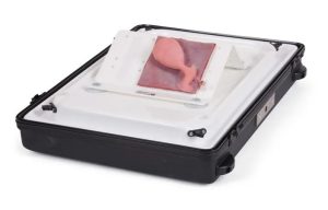 Gall Bladder with Bifurcated Cystic Artery