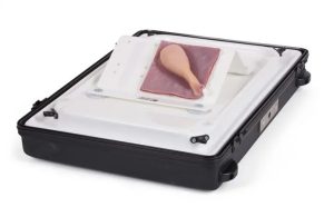 Gall Bladder with Short Cystic Duct