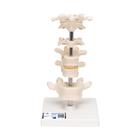 Model of 6 Human Vertebrae, Mounted on Stand (atlas, axis, cervical, 2x thoracic, lumbar)