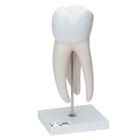 Giant Molar with Dental Cavities Human Tooth Model, 15 times Life-Size, 6 part