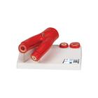 Arteriosclerosis Model, with Cross Section of Artery, 2 part