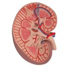 Basic Kidney Section Model, 3 times Full-Size