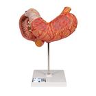 Human Stomach Model, 3 part