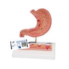 Human Stomach Section Model with Ulcers