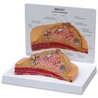 Breast Cross-Section Model