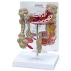 Colon Model