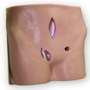 Hernia Reapir Model
