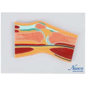 SKU: MG17222  Knee Model, Median Section