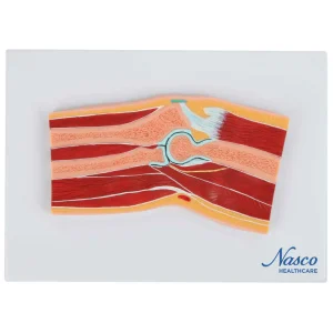 SKU: MG17225  Elbow Model, Median Section