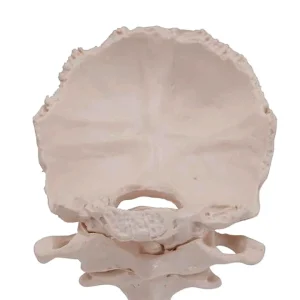 SKU: MG20268  Atlas and Axis with Occipital Plate Model