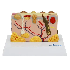 SKU: MG21065  Skin Section with Pathology Model, 30X Enlarged