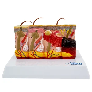 SKU: MG21066  Skin Section with Burn Model, 30X Enlarged