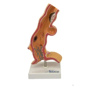 SKU: MG22729  Esophageal Disease Model, 5X Enlarged