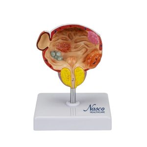 SKU: MG22730  Bladder and Prostate Diseases Model