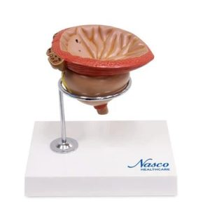 SKU: MG30752  Enlarged Prostate Model, 4 Parts