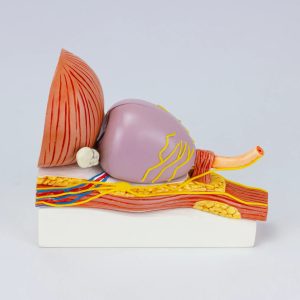 SKU: MG34924  Prostate with Pathology Model