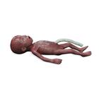 Lifecast Micro-preemie Baby / Extremely Low Birth Weight Baby (ELBW)