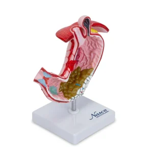 SKU: MG23162  Stomach with Gastric Ulcers Model