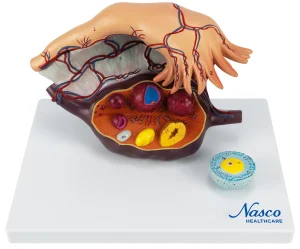 SKU: MG23170  Ovary Model, 5X Enlarged, 2 Parts