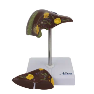 SKU: MG23415  Liver Section with Pathology Model, 2 Parts