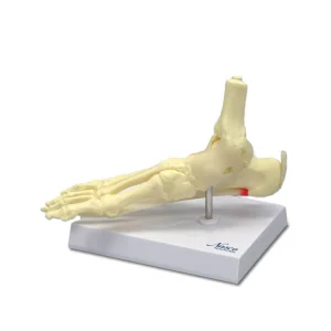 SKU: MG29758  Foot and Ankle with Plantar Fasciitis Model