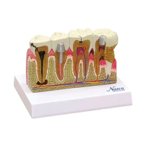 SKU: MG29771  Teeth Model