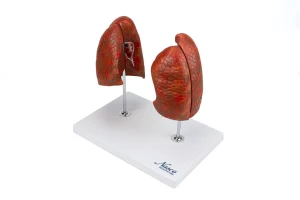 SKU: MG29786  Lung Model, 4 Parts