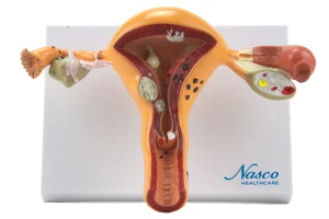 SKU: MG29789  Uterus & Ovary with Pathologies Model