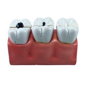 SKU: MG29837  Dental Morphology Model, 4X Enlarged, 7 Parts