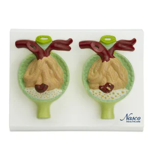 SKU: MG29879  Nephrons with Pathology Model, 300X Enlarged