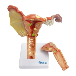 SKU: MG29947  Female Genital Organ with Pathology Model, 2 Parts