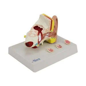 SKU: MG29985  Ear with Pathology Model, 1.5X Enlarged