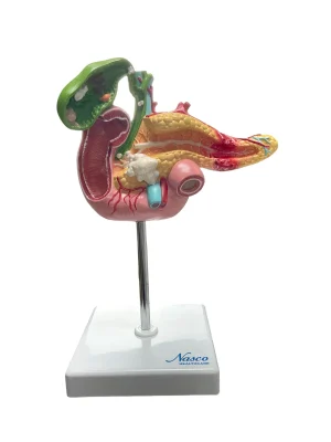 SKU: MG30031  Pancreas, Duodenum, & Gallbladder with Pathology Model