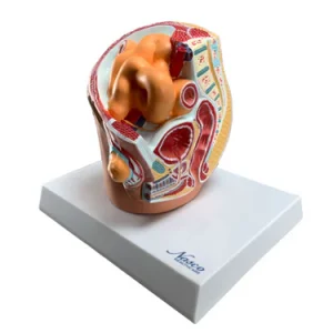 SKU: MG30132  Pelvis with Indirect Inguinal Hernia Model, Half-Size