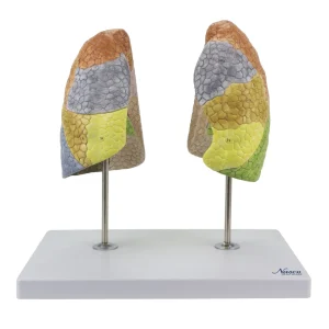 SKU: MG30886  Segmented Lung Model