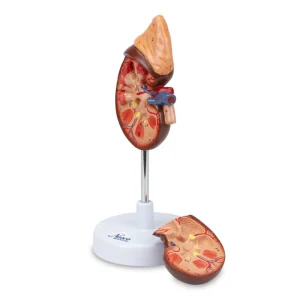 SKU: MG31016  Kidney with Adrenal Gland Model, 1.5X Enlarged, 2 Parts