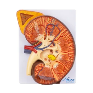 SKU: MG31103  Kidney Section with Adrenal Gland Model, 3X Enlarged