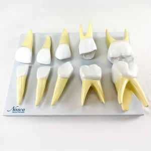SKU: MG31150  Baby Teeth Models, 10X Enlarged