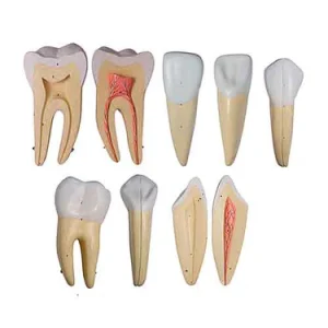 SKU: MG31151  Teeth Models, 10X Enlarged, 5 Part