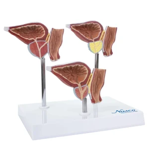 SKU: MG31153  Normal and Pathological Prostate Models, 3 Parts