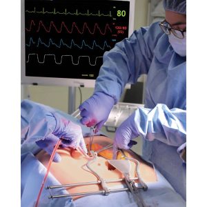 Universal Surgical Abdomen Team Training System