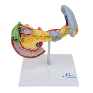 SKU: MG14742  Pancreas, Spleen, and Gallbladder with Pathologies Model
