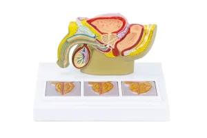 SKU: MG34916  Male Pelvis with Prostate Model, Half-Size