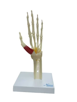 SKU: MG35507  Carpel Tunnel Syndrome Model