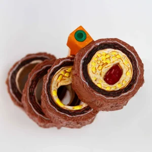 SKU: MG35513  Arteriosclerosis Model, 4 Stages