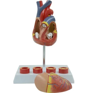 SKU: MG35530  Heart with Arteriosclerosis Model